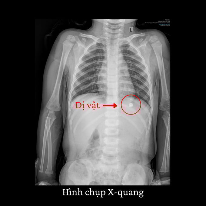 Be-trai-2-tuoi-nuot-tron-oc-vit-sac-nhon