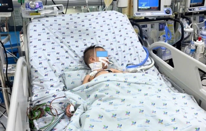 Bệnh nhân mắc tay chân miệng độ 3, kèm tăng huyết áp (Ảnh: BVCC)