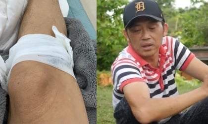 Hoài Linh đăng ảnh bị thương nằm băng bó trong viện khiến loạt sao Việt phải xót xa