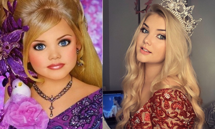 Hoa hậu nhí nước Mỹ bị 'chín ép' một thời: Tiêm botox và ăn kiêng mỗi ngày, sau 9 năm từ nhan sắc đến cuộc sống đều gây bất ngờ