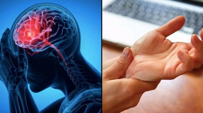 đột quỵ trước một tuần 0 đột quỵ trước một tuần 0